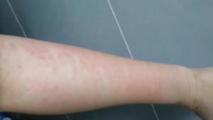 官方通报袋鼠妈妈被曝虚假宣传 孕妇适用疑云引发关注