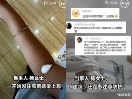 女子公司如厕感染粪便病菌，无法吞咽 公厕卫生隐患需警惕
