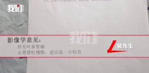 良性肿瘤变肝癌时隔8年报告反转 医院回应：家属取报告太早