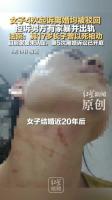 4次起诉离婚被驳回女子发声 家暴与争议中的坚持
