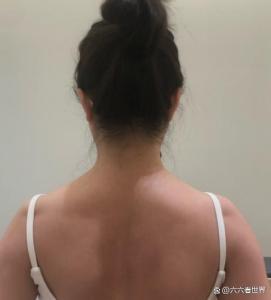 40岁后肩膀“断崖式”衰老？这并非危言耸听！