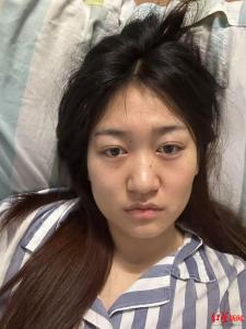 公厕被打3年后女孩患白血病求助 急需骨髓移植