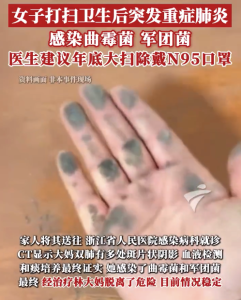 女子大扫除后剧烈咳嗽发高烧 医生建议年底大扫除时戴N95口罩