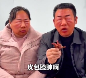 吃野菜的第一批受害者出现了 脸肿得像被一窝蜜蜂蛰过 亲妈都难认!