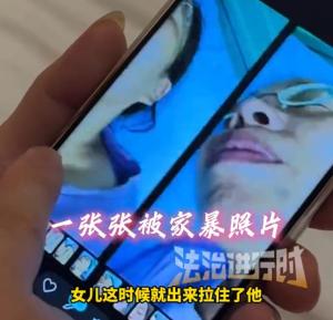 53歲女子遭多年家暴拍下132張傷情照 法律與社會共筑反家暴防線