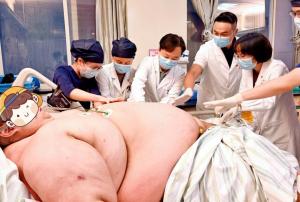 635斤小伙跨省减重 家人包车开23小时 成功闯过首道关卡