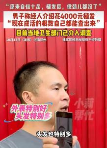 男子4000元做植发后直呼后悔 效果远不及预期