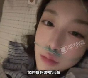 女生便秘揉肚子造成腹腔出血 医生：太瘦了，只能手术治疗