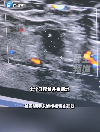 全職媽媽查出乳腺癌不敢告訴女兒 手術(shù)前寫下真情告白