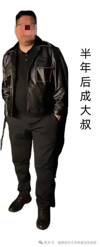 福州男子減肥一年增重30公斤 罕見(jiàn)病庫(kù)欣綜合征作祟
