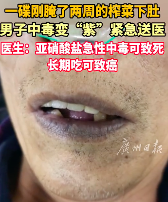 男子吃腌菜中毒變“紫”緊急送醫(yī) 醫(yī)生：亞硝酸鹽急性中毒致死，長期吃致癌