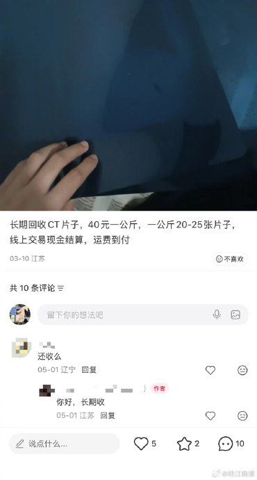 原来路边收X光片是这来做这个的