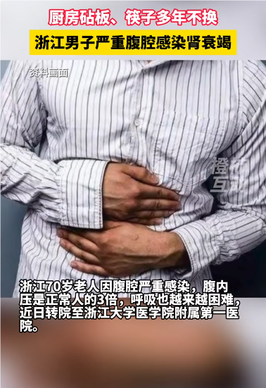砧板筷子多年不换男子严重腹腔感染 家庭卫生隐患曝光