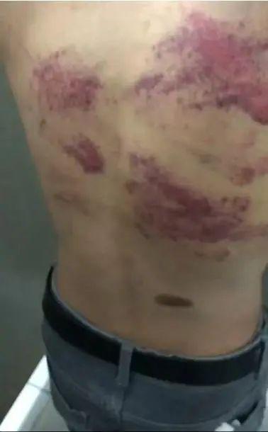 21岁小伙被骗至缅甸妙瓦底，遭殴打求救 历经9月终获救