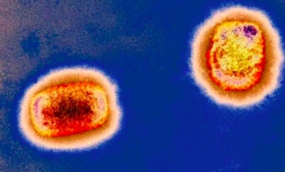 猴痘病毒疫情已现人际传播，八问猴痘病毒