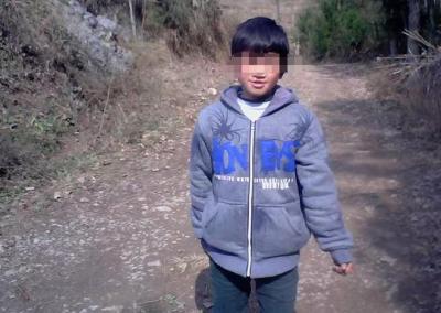 24岁唇腭裂患者发声：接受了免费手术