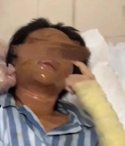 邮寄包裹炸伤女主播男子被警方刑拘 恶意报复引发关注