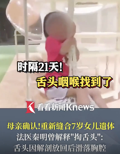 女童遗体丢失的舌头咽喉已缝合修复！