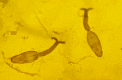 接触10秒即可感染 看到这种螺快报告