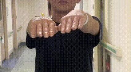 男子喝酒熬夜15天確診“腦子壞了” 過(guò)度透支身體拉響警報(bào)