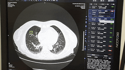 诊室里的扫码声—看看这家医院“便民就医”微改革
