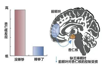 你以为正常，实则可能是严重缺觉的4种表现 身体警报需重视