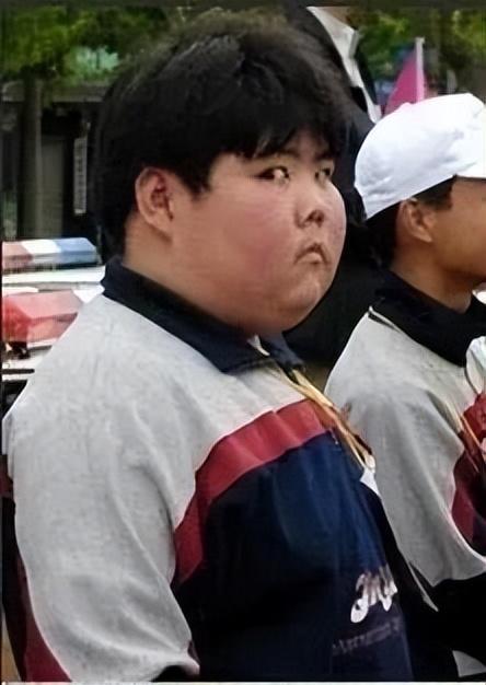 “网络小胖”患肾脏疾病样貌大变