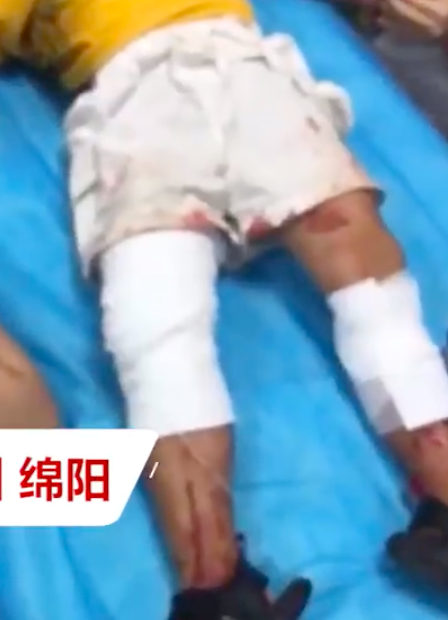 3岁幼童被牵绳大狗咬伤