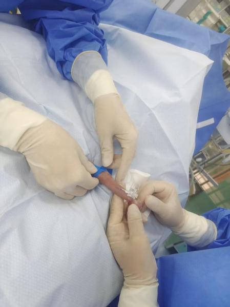 600g超早产宝宝闯过数道鬼门关出院 158天的生命奇迹