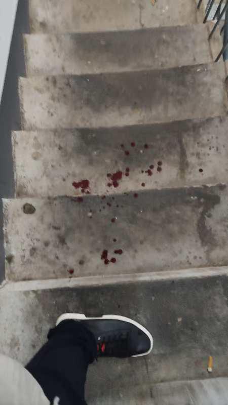 男子斥責(zé)不拴繩遭狗主人打還被尾隨