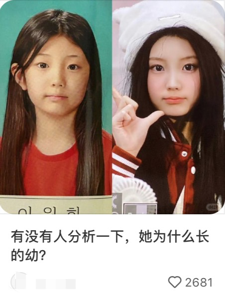 幼态审美盯上女生的牙齿 畸形美感背后的疯狂追捧