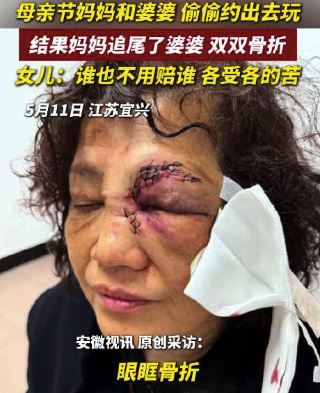 婆婆和媽媽騎車追尾雙雙骨折 女兒：誰(shuí)也不用賠誰(shuí) 各受各的苦