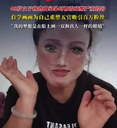 48岁女子称逃离家暴时被泼硫酸严重毁容 自学绘画重塑五官获百万粉丝