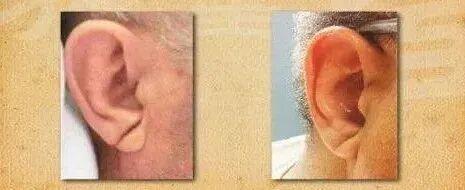 心脏不好脸上会报警 面部信号需警惕