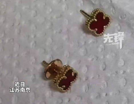 女子忘摘耳钉耳堵长进肉里开刀取出 医生提醒