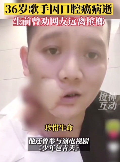 画面残忍：半边脸溃烂！36岁歌手嚼槟榔6年因口腔癌过世