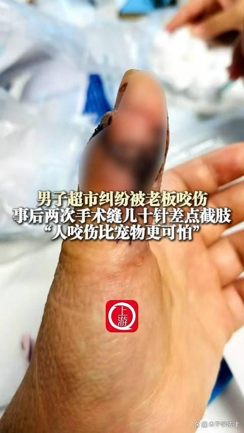 男子因糾紛被超市老板咬傷險(xiǎn)截肢 野蠻行為引發(fā)熱議