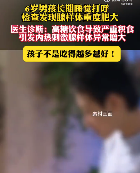 男童长期积食腺样体快堵死呼吸道 医生提醒孩子不是吃得越多越好