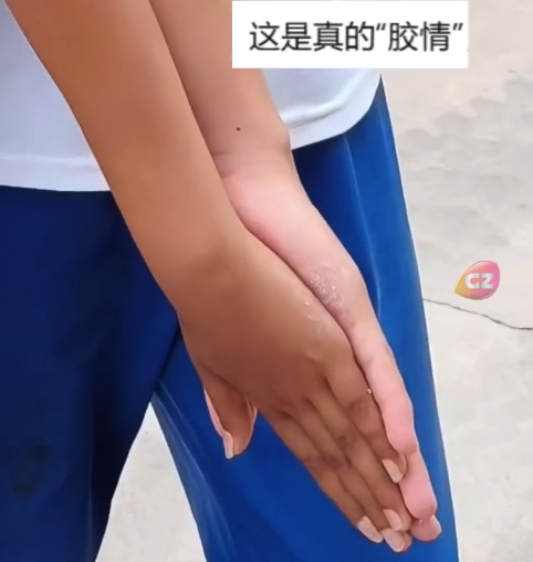 学生手掌不慎被”502”胶水粘住 “手牵手”求助消防员
