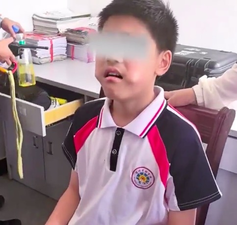 小孩哥牙齦發(fā)癢用尺子當癢癢撓被卡 消防員僅1分鐘就完成