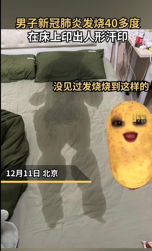 男子发烧近40度床上印出人形汗印