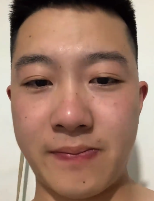 断崖式戒烟一个月的面部变化！