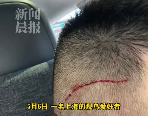 公园回应男子拍鸟被揍负伤：凤头鹰为猛禽，最近正值育雏期，非必要不要打扰
