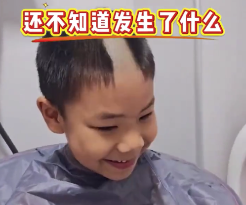 爸爸给儿子理发忘装卡尺秒变地中海 儿子：明天怎么上学丢死人了