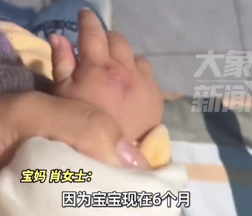 6个月大宝宝碰到充电线头手被烫伤 宝妈：万一用嘴咬后果将不堪设想