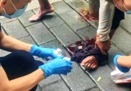男子腿部血管突然爆裂血流一地