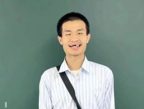 北大“韦神”患上这种牙病！从偶尔刷牙出血，到牙齿掉光仅有三步！