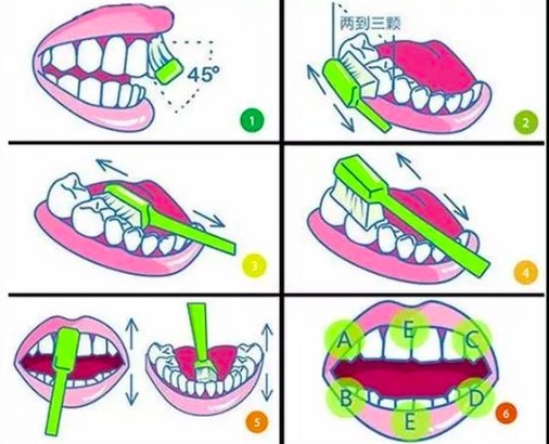 横向刷牙会导致牙龈萎缩吗？是正确的刷牙方式吗？