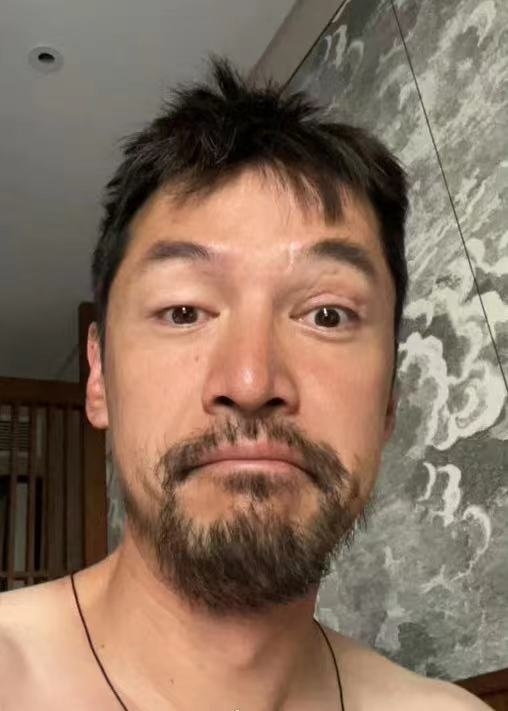 胡歌状态引发网友担忧 凌晨晒照满脸胡须露车祸伤疤