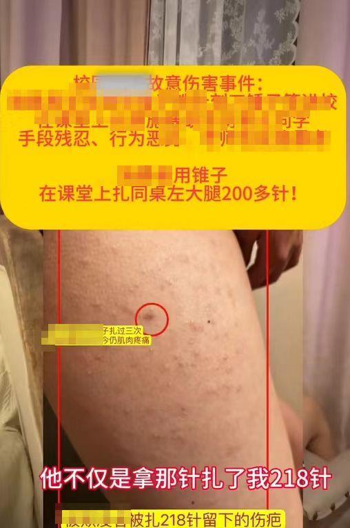 女生被扎218针为何未达校园霸凌标准